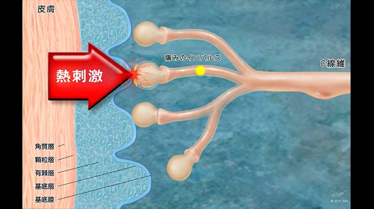 Chapter-1 侵害受容とイオンチャネル
