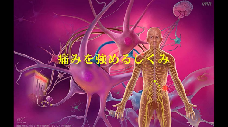 Chapter-6 痛みを強めるしくみ